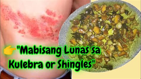 kulebra treatment